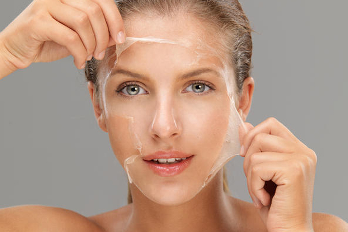 Il Peeling Chimico