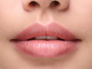 filler-labbra